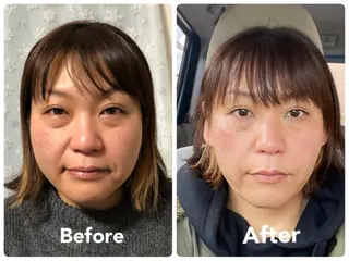 小顔矯正サロン スターローズのエステ・リラクイメージ