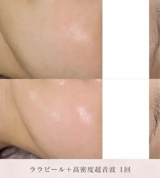 美肌・小顔専門🪄 看護師施術/松﨑のエステ・リラクイメージ