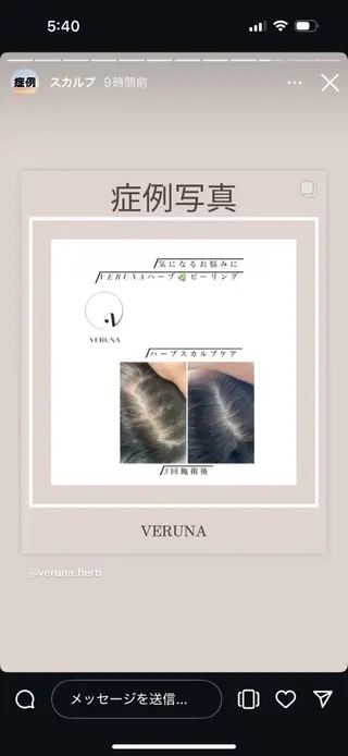 ハーブピーリング専門 グランディール　武内のエステ・リラクイメージ