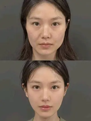 マツエク・マツパ aliaハーブ水光店 エステティシャン募集のエステ・リラクイメージ