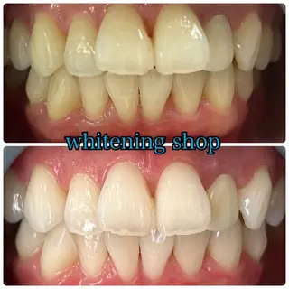 ホワイトニング ショップ津店のその他イメージ