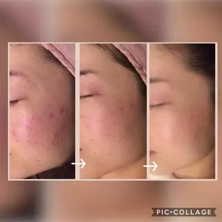 美肌蘇生カウンセラー 横山りえのエステ・リラクイメージ