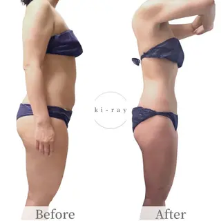 綺麗のひみつ グランプリ受賞店のエステ・リラクイメージ