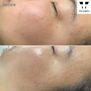 肌育・肌質改善サロン 🫧ニナル🫧のエステ・リラクイメージ