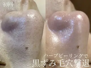 艶肌デトックス🫧 Samiraのエステ・リラクイメージ