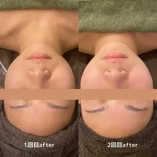 DUPE&MORE 店長kanaeのエステ・リラクイメージ