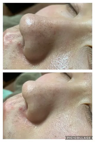 朝重い人専用 肩甲骨調整のエステ・リラクイメージ