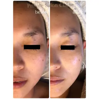 体の中から肌質改善 クレール　奈良のエステ・リラクイメージ