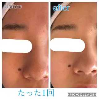 ミディアム カラー パーマ ヘアアレンジ キッズ ネイル マツエク・マツパ EnsorClair 代表 野口真央のエステ・リラクイメージ