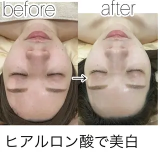 laluna saki...のその他イメージ