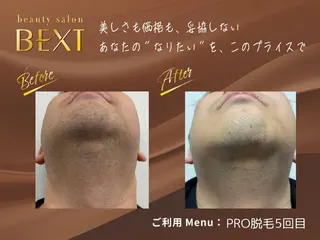 メンズ ビューティーサロン ベクスト名古屋のエステ・リラクイメージ