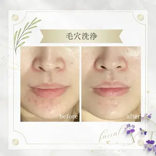 《 肌質×美肌 》 addissimoのエステ・リラクイメージ