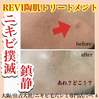 salon  mebell所属・肌管理専門店 mebell天王寺店のエステ・リラクイメージ