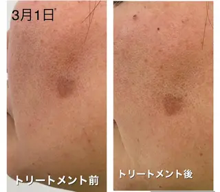 ノエビア ラボーテサロンのエステ・リラクイメージ