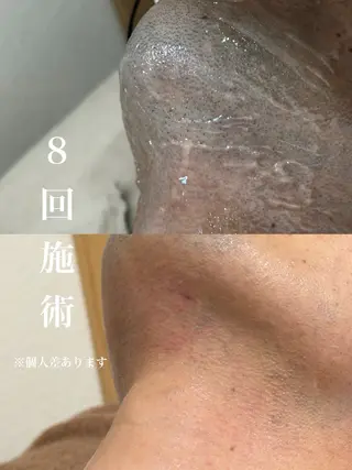 メンズ muumo まりののエステ・リラクイメージ