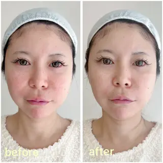 ﾊﾟｰｿﾅﾙｶﾗ-/ ﾒｲｸ/ｴｽﾃ/骨格のエステ・リラクイメージ