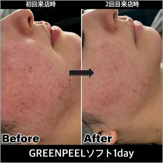 ULT ultimateskin所属・ULT ウルトのエステ・リラクイメージ