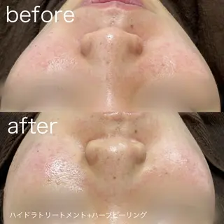 lulularico Yuのエステ・リラクイメージ