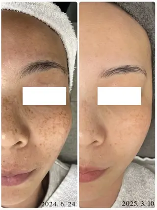 メンズ えだ すがこのエステ・リラクイメージ