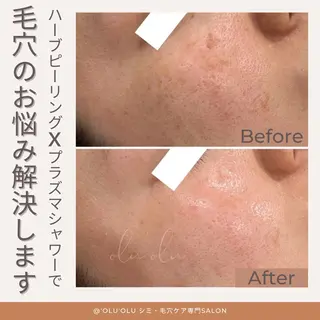 〈医療提携/毛穴・シミケア専門店〉 'Olu'Olu【オルオル】所属・'Olu'Olu シミ・毛穴専門サロンのエステ・リラクイメージ