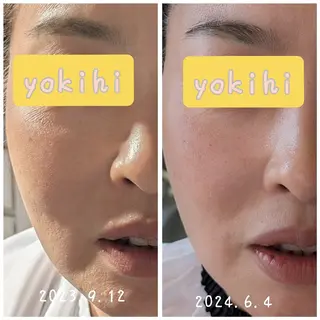 結果が出るスキンケア 肌質改善/まつパのエステ・リラクイメージ