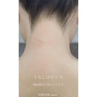 ワックス脱毛🌈 ESPOIRnocoのエステ・リラクイメージ
