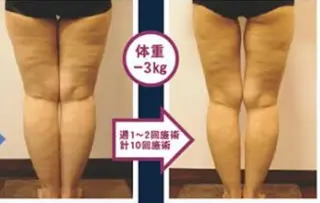 オイル＆フェイシャル 【月のあかり🌙】のエステ・リラクイメージ