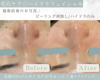 Salon💫 Lino'a柏店のエステ・リラクイメージ