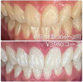 メンズ ホワイトニング ルーム　川崎店のその他イメージ