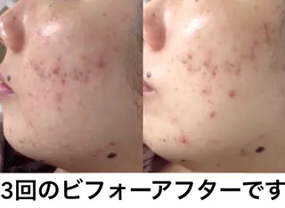 ミディアム カラー パーマ ネイル マツエク・マツパ 都度払い肌質改善 &脱毛Blancheのエステ・リラクイメージ