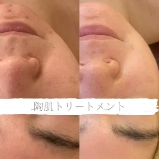 小顔&デコルテ Spa “koti”のエステ・リラクイメージ