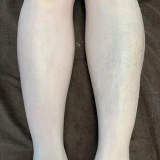 Dahliaダリア シュガーリングサロンのエステ・リラクイメージ