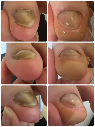 ネイル Belulu ベルルのネイルデザイン