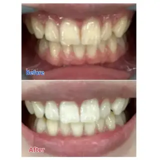 M渋谷 ホワイトニングのエステ・リラクイメージ