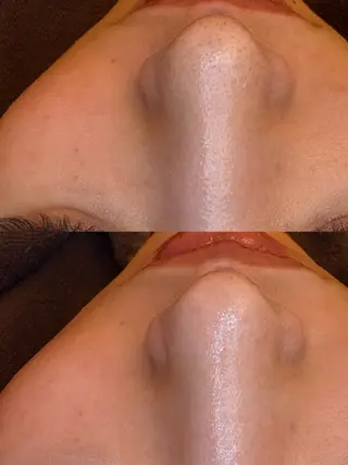 🤍アベシュリ /フェイシャル🤍のエステ・リラクイメージ