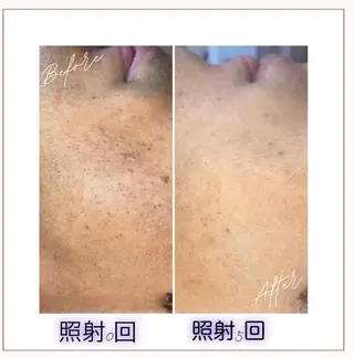 ピーリング＆脱毛 maoのエステ・リラクイメージ