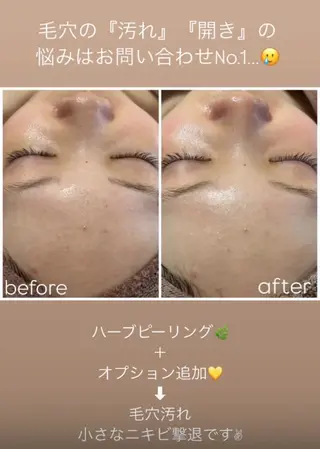 WHITE AQUA 🌼柏店のエステ・リラクイメージ