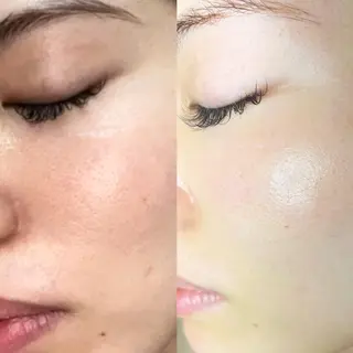 全身脱毛/韓国ツヤ肌 ハーブピーリングのエステ・リラクイメージ