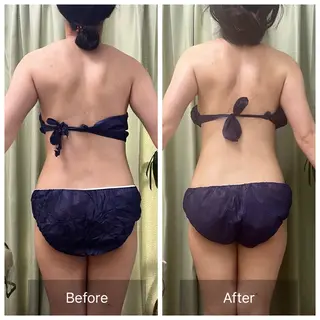 【元に戻らない】 小顔&部分痩せのその他イメージ