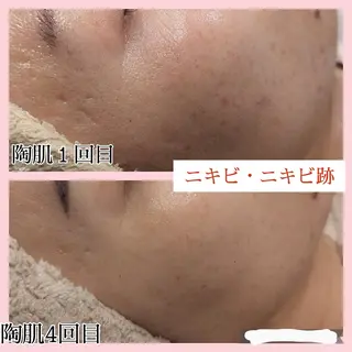 肌質改善サロン with Uのエステ・リラクイメージ