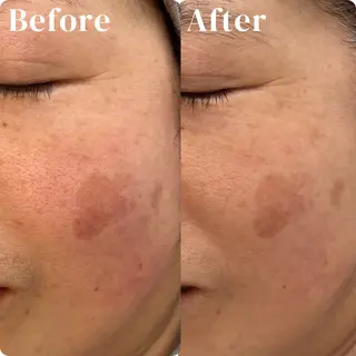 AIMER アイブロウ／エステのネイルデザイン