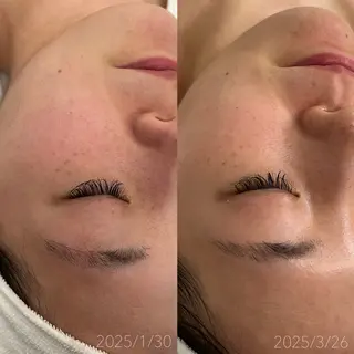 肌質改善サロン🫧 MAIのエステ・リラクイメージ
