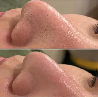 A"-HILU （アーヒル)のエステ・リラクイメージ