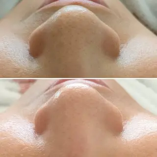 メンズ 美 Faceのエステ・リラクイメージ