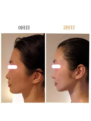 小顔salon 古田琴のエステ・リラクイメージ
