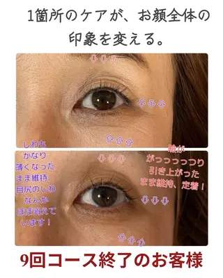 Dimples所属・Dimples eyelashのマツエク・マツパデザイン