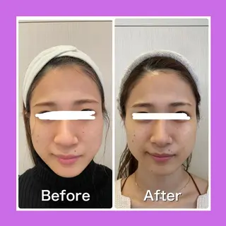 SUN&MOON REOのネイルデザイン