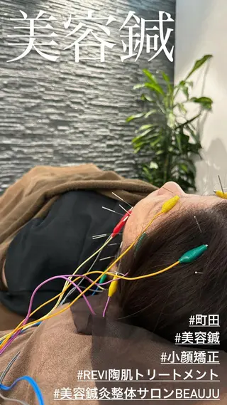 小顔矯/美容鍼/鍼灸 BeauJuのその他イメージ