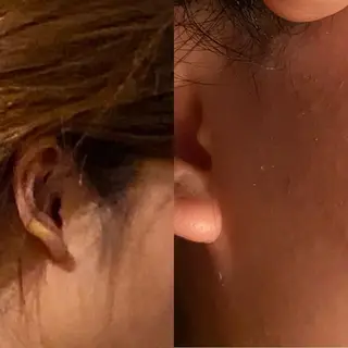 カラー キッズ ネイル AKALA エステ リンパマッサージのエステ・リラクイメージ