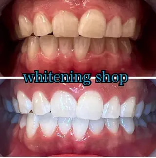 ホワイトニング ショップ津店のその他イメージ